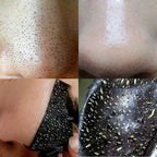10pcs Nose Blackhead Remover Strips Mask Skin Care Shrink Pore Acne Treatment Mask Deep Nose Pore Cleansing Strips Black Head Remover