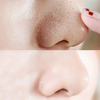 10pcs Nose Blackhead Remover Strips Mask Skin Care Shrink Pore Acne Treatment Mask Deep Nose Pore Cleansing Strips Black Head Remover