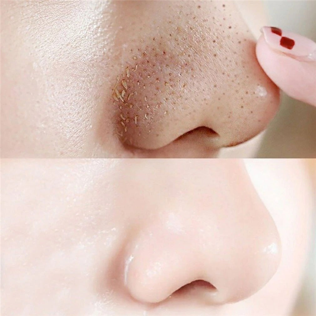 10pcs Nose Blackhead Remover Strips Mask Skin Care Shrink Pore Acne Treatment Mask Deep Nose Pore Cleansing Strips Black Head Remover