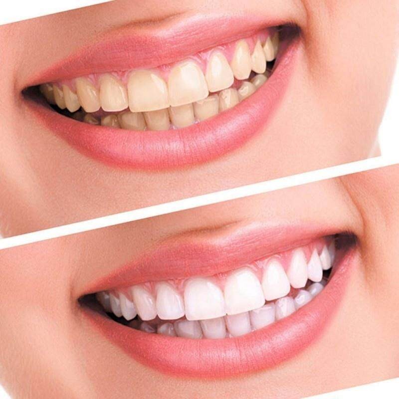 Pcs/Bag A2dvanced Teeth Whitening Strips Teeth Oral Hygiene Care Dental Bleaching Teeth Strips Whitening Dental Bleaching Tools